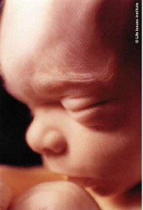 Unborn baby picture