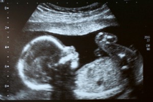 Ultrasound: Window to the Womb